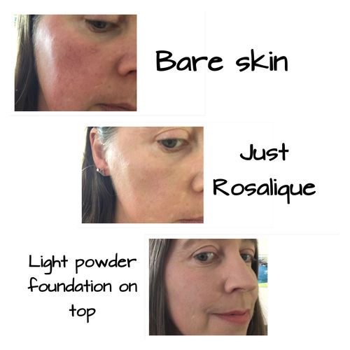 Customer photo review of Rosalique 3 in 1 Anti-Redness Miracle Formula SPF50
