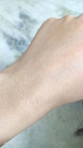 Customer photo review of Shadow Sunscreen SPF 30+ Gel - Sunscreen For Oily Skin - Acne Prone