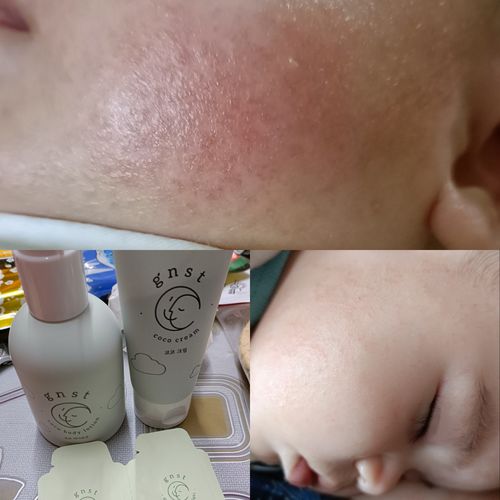 Customer photo review of Coco 濕疹修護霜 80ml