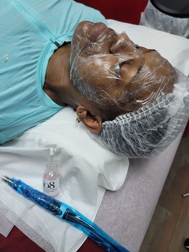 Customer photo review of 12 Pin Cartridges for A7 (10 Pack)