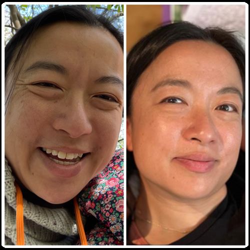 Customer photo review of Rosalique 3 in 1 Anti-Redness Miracle Formula SPF50