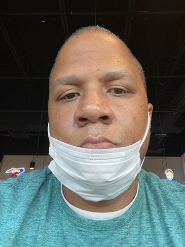 Customer photo review of BERRI-CLEAR+ 5 BERRY SUPERFRUIT SERUM