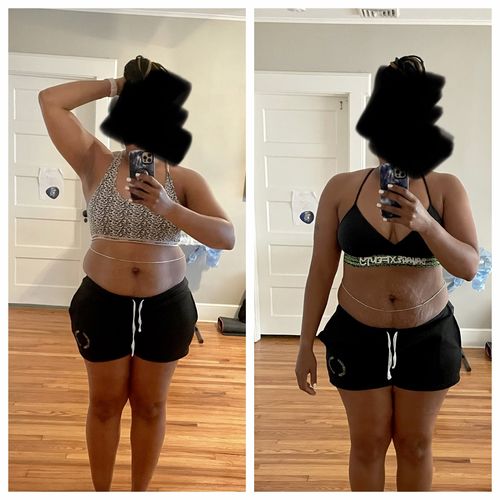 Customer photo review of 90 Uses Full Body (arms/legs/core) with Renewal Serum