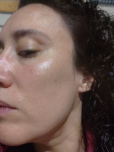 Customer photo review of Solução Vitamina C