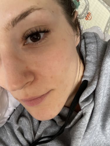 Kundenbewertung mit Foto zu Flutter Fling