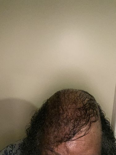 Customer photo review of CAFFEINE INFUSED HAIR GROWTH BUTTER