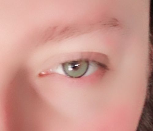Customer photo review of Neala Green Contact Lenses(12 months wear)