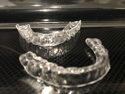 Customer photo review of Upper and Lower Retainers