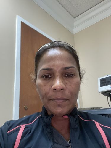 Customer photo review of Glow To Sleep Oil | Facial Oil