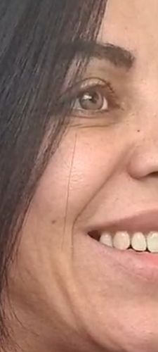 Customer photo review of Moira Green Contact Lenses(12 months wear)