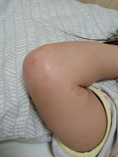 Customer photo review of Coco 濕疹修護霜 80ml