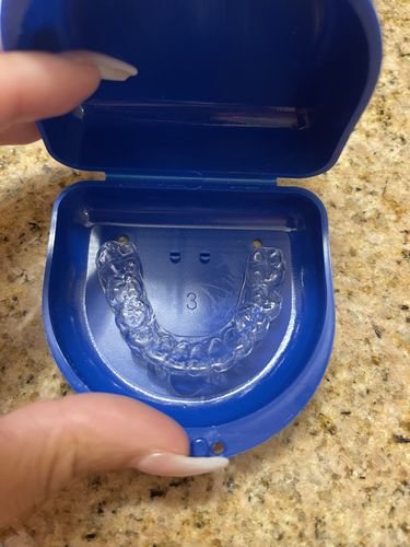 Customer photo review of Extra Impression Putty (STRONGLY RECOMMENDED)