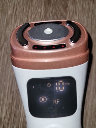 Customer photo review of New Mini Hifu 2nd Generation - Ultrasonic Antiaging Machine - Mini Hifu