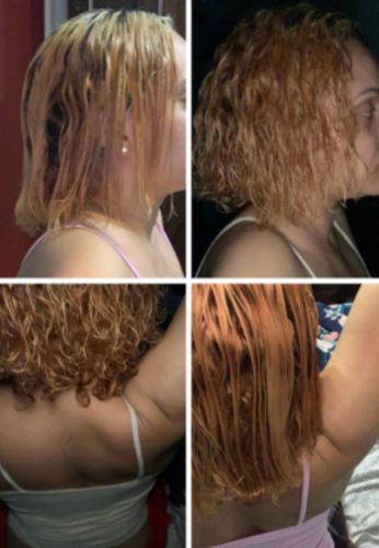 Customer photo review of HairRebirth Herbal Spray(Limited time discount 🔥 last day)