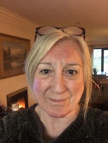 Customer photo review of Healing Miracle Cream
