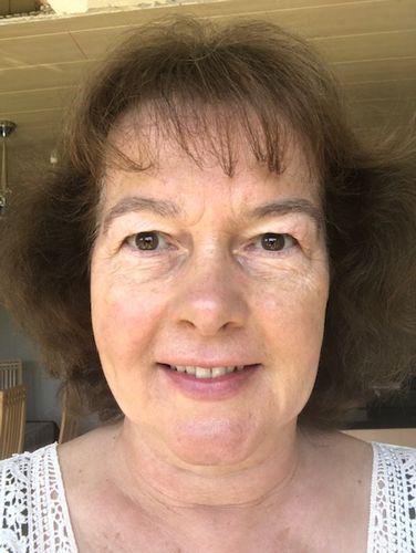 Customer photo review of Rosalique 3 in 1 Anti-Redness Miracle Formula SPF50