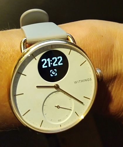 Kundenbewertung mit Foto zu Withings ScanWatch
