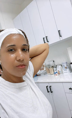 Customer photo review of SkinFix: Microneedling