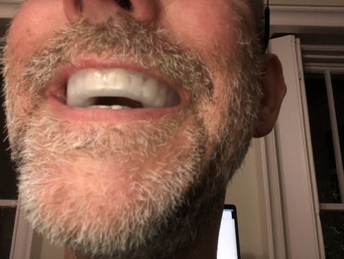 Customer photo review of 14 Day Special Offer