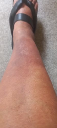 Customer photo review of Skin Saviour Balm