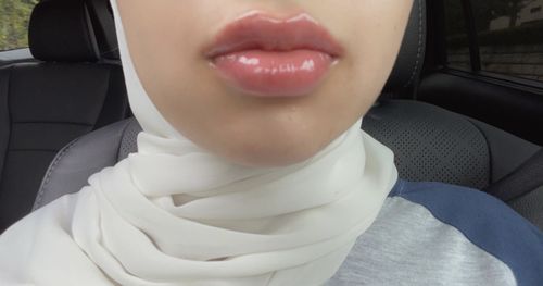Customer photo review of LipFix: Filler