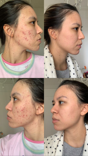 Customer photo review of Solução Niacinamida