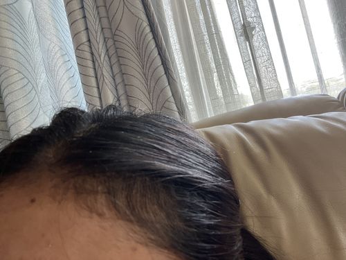 Customer photo review of Glow + Grow Hair Growth Collagen Starter Kit