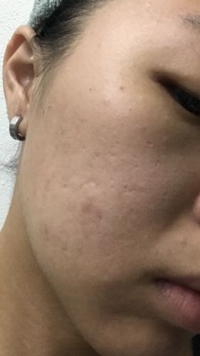 Customer photo review of CLEF Anti-Aging Cleansing Gel