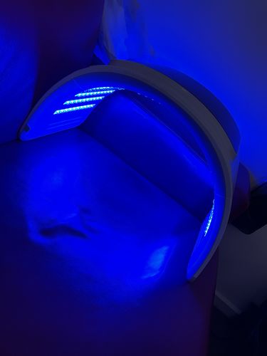 Customer photo review of Femvy LED Light Therapy Pod