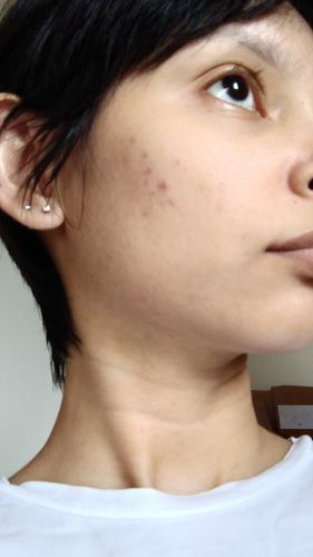 Customer photo review of Solução Retinol-Like