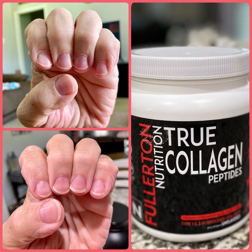 Customer photo review of True Collagen Protein