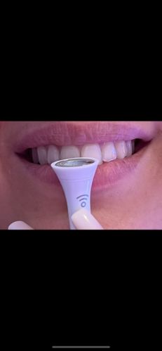 Customer photo review of PAP+ Complete Set