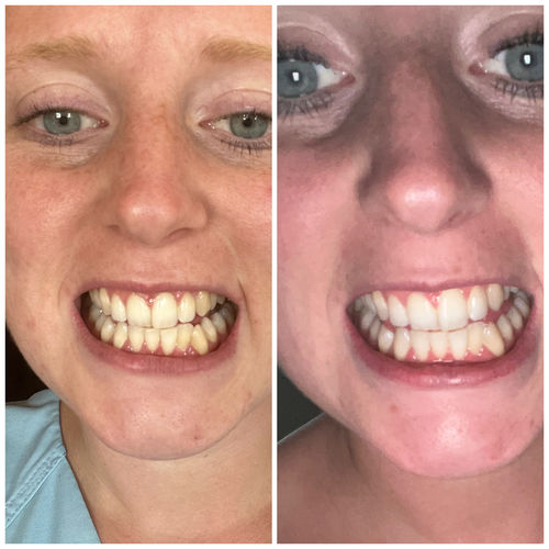 Customer photo review of 2597 C Color Corrector Foam