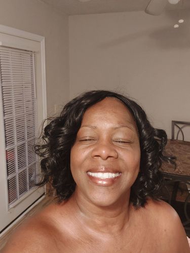 Customer photo review of Beauty Serum Set (6-Pack)