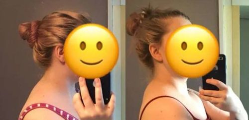 Customer photo review of TechTico EMS Lymphatic Relief Neck Massager
