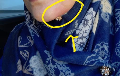 Customer photo review of Jolicare Cream