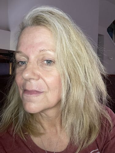 Customer photo review of EvenSkyn® Lumo: Premium Anti-Aging & Skin Tightening Handset