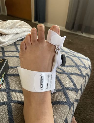 Customer photo review of The BigToeHero™