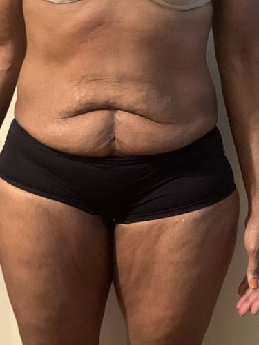 Customer photo review of FREE (just pay shipping) Cotton Wrap and Refill Magnesium Therapy Brew Bag