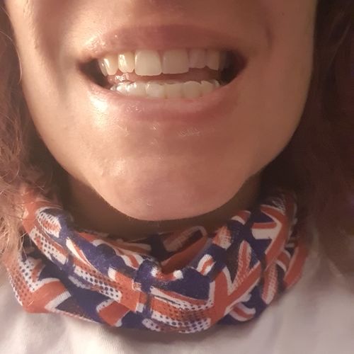 Customer photo review of SleepPro Slimline Night Guard 1.5mm