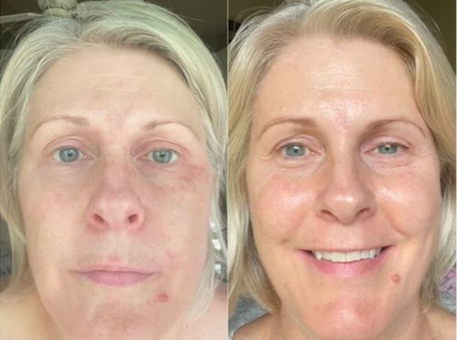 Customer photo review of DermaSoie Sérum Jour Liftant