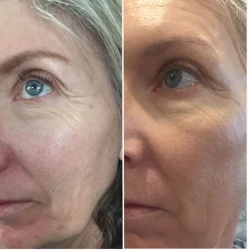 Customer photo review of DermaSoie Sérum Jour Liftant