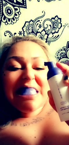 Customer photo review of Gratis PAP+ Whitening Strips