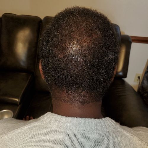Customer photo review of CAFFEINE HAIR GROWTH BUTTER