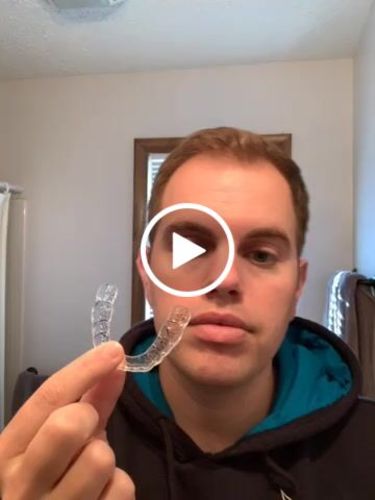 Customer video review of Extra Impression Putty (STRONGLY RECOMMENDED)