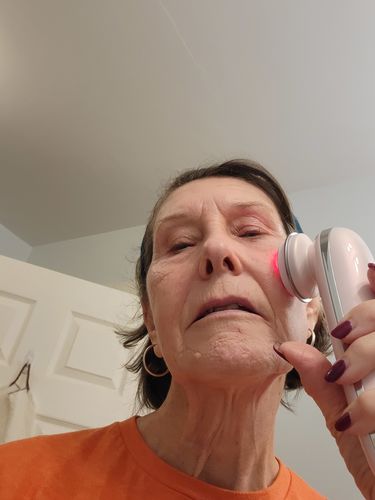 Customer photo review of EvenSkyn® Lumo: Premium Anti-Aging & Skin Tightening Handset