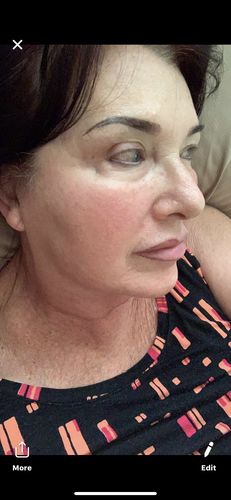 Customer photo review of Growth Factor & Triple Peptide Eye Serum Bundle! Save $5.00 (BUNDLE OF 2) πΏ