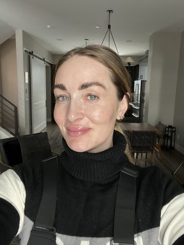 Customer photo review of EvenSkyn® Lumo: Premium Anti-Aging & Skin Tightening Handset