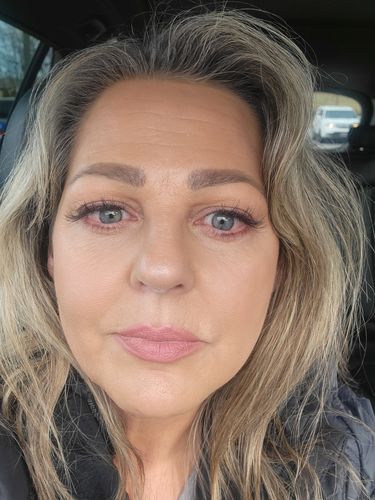 Customer photo review of EvenSkyn® Lumo: Premium Anti-Aging & Skin Tightening Handset