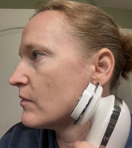 Customer photo review of EvenSkyn® Lumo: Premium Anti-Aging & Skin Tightening Handset